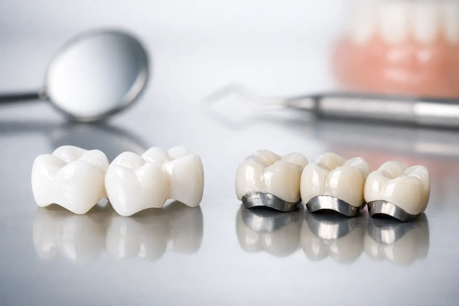 Corone in zirconia o metallo ceramica?
