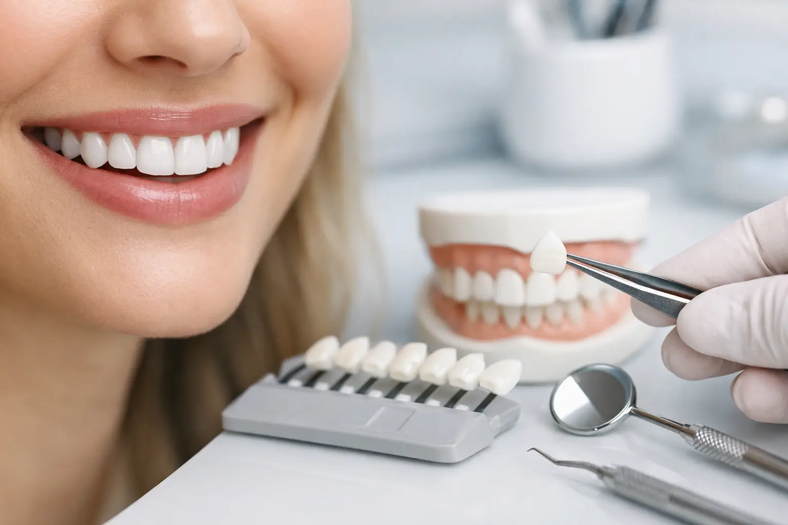 Guida alle faccette per un sorriso naturale